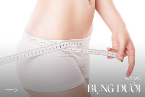 Hút mỡ bụng dưới